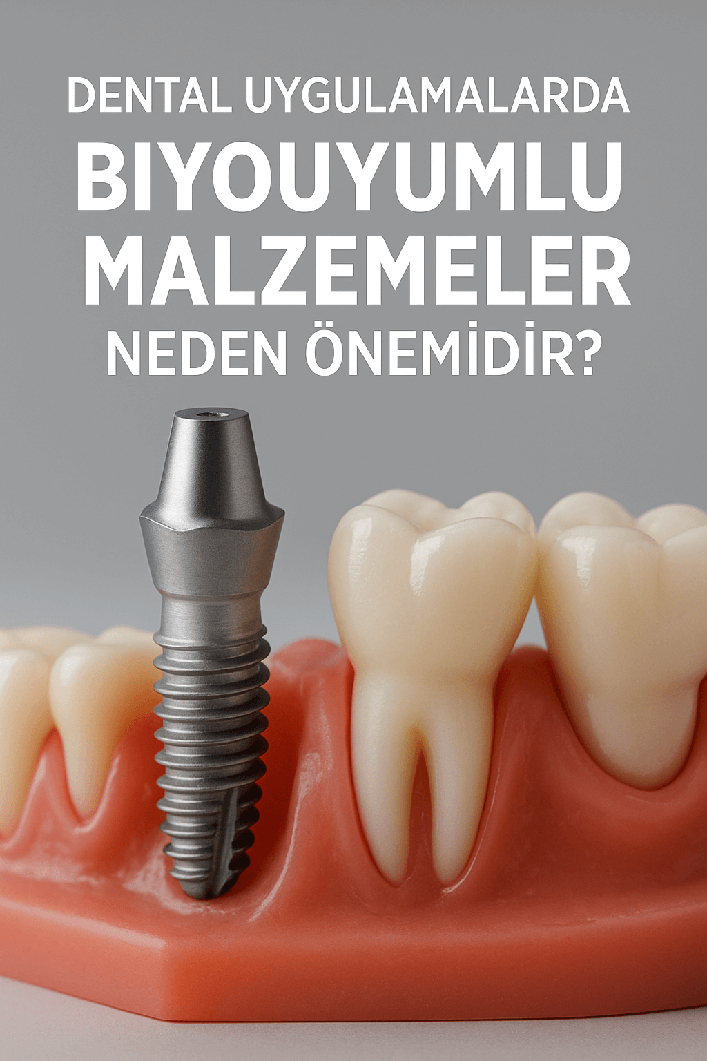 Dental Uygulamalarda Biyouyumlu Malzemeler Neden Önemlidir?